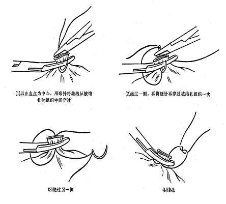 赠卵试管婴儿和自然受孕哪个更好？高龄孕妇如何选择