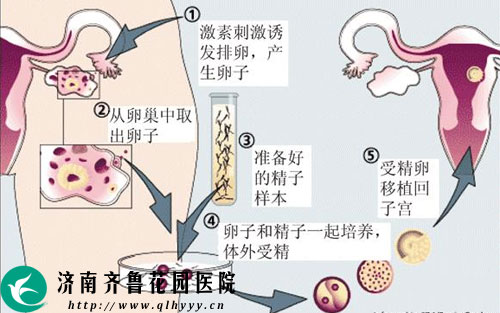 移植后的黄体酮臀部疼痛可以改用Xanax吗？