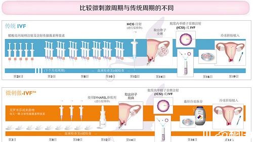 单身女性赠卵试管