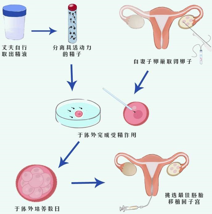 南通第三代做供卵试管婴儿龙凤胎多少钱