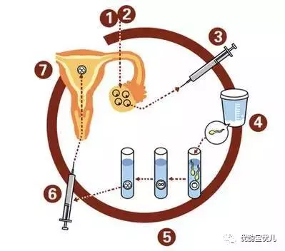 试管代怀花多少费用妈妈是不是要天天打针